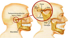 Diagram of Temporomandibular Joint in the human head.